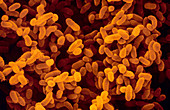 SEM of Klebsiella pneumoniae bacteria