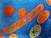 TEM of pseudomonas aeruginosa bacteria