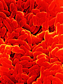 Mycobacterium tuber- culosis bacteria