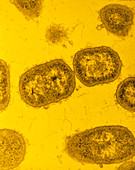 TEM of Bacteroides gingivalis bacteria