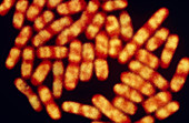 Typhoid bacteria (Salmonella typhi)