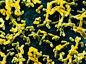 Coloured SEM of Yersinia pestis bacteria