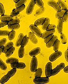 TEM of Bordetella pertussis bacteria