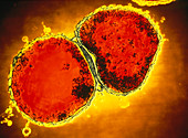 TEM of neisseria meningitidis bacteria