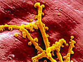 Flavobacterium meningo- septicum bacteria