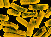 Clostridium perfringens bacteria