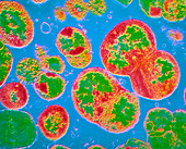 TEM of neisseria gonorrhoeae bacteria
