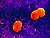 Acinetobacter calco- aceticus bacteria