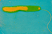 Vibrio cholerae bacterium