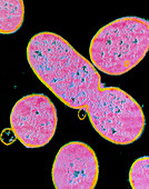 TEM of Shigella sp. bacteria