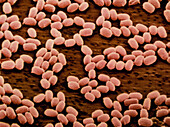 Coloured SEM of anthrax bacteria spores