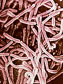 SEM of lactobacillus bulgaricus bacteria