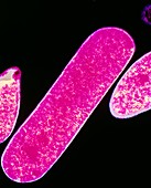 Clostridium perfringens bacteria