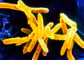 Cardiobacterium hominis bacteria