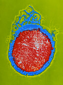 Neisseria gonorrhoeae bacteria