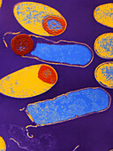 Clostridium botulinum bacteria with spores