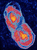 Coxiella burnettii bacterium dividing