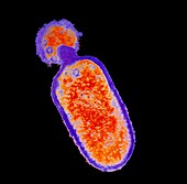 Listeria monocytogenes bacterium