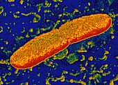 Two Yersinia pestis bacteria