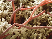 SEM of Lactobacillus bulgaricus bacteria