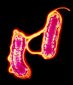 Two Helicobacter pylori bacteria