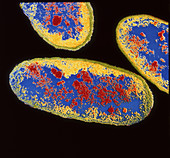 Pneumonia bacteria