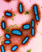Mitsuokella dentalis bacteria