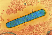 Anthrax bacterium
