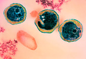 Chlamydia bacteria