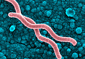 Helicobacter pylori bacteria