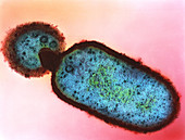 Listeria monocytogenes bacteria,TEM