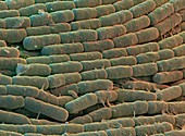 Bacillus cerus bacteria,SEM