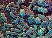 Kitchen bacteria,SEM
