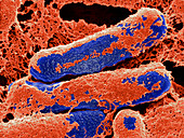 SEM of Clostridium botulinum bacteria