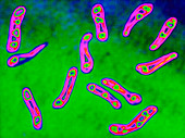 Diphtheria bacteria,TEM