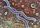 Helicobacter pylori bacteria,SEM