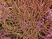 Tongue bacteria,SEM