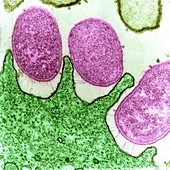 Helicobacter pylori bacteria,TEM