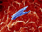 Bacteria infecting a macrophage,SEM