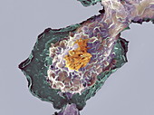 Bacteria infecting a macrophage,SEM