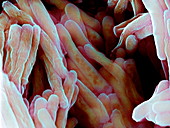 Tuberculosis vaccine bacteria,SEM