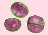 Staphylococcus aureus dividing,TEM
