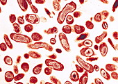 Q fever bacteria,Coxiella burnetii,TEM