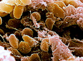 Plague bacteria,Yersinia pestis,SEM