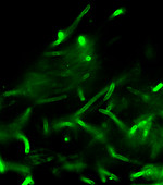 Anthrax bacteria,light micrograph