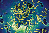 Mycobacterium chelonae bacteria,SEM