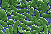 Vibrio vulnificus bacteria,SEM
