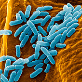 Pseudomonas aeruginosa bacteria,SEM