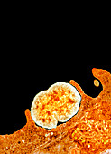 Gonorrhoea bacteria,TEM