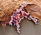 Helicobacter pylori bacteria,SEM